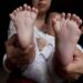 il-bimbo-nasce-con-31-dita