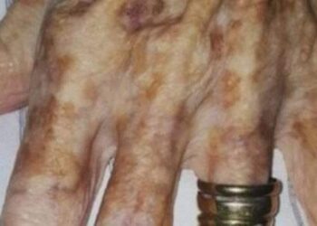 Un’anziana paziente chiede all’infermiera di metterle lo smalto . Ciò che accade dopo è commovente!