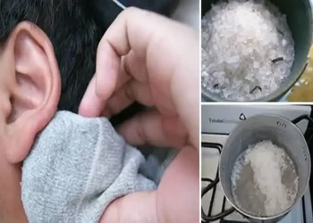 ecco come puoi curare la cervicale con il sale cotto