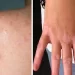 Intolleranza al glutine, i 10 sintomi principali di questo disturbo