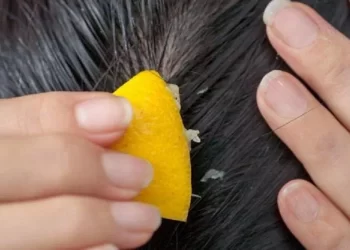 Mettete un limone in testa