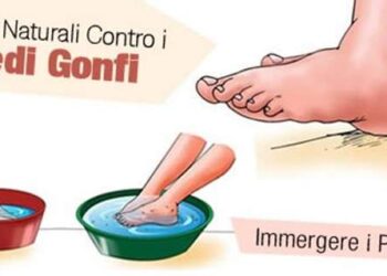Piedi gonfi: come sbarazzarsene in pochi minuti e in modo naturale