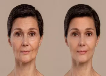 La vitamina che triplica la produzione di collagene ed elimina le rughe