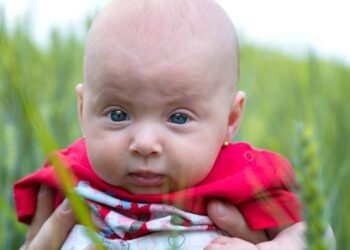 Mia figlia calva per colpa di mia suocera", il duro sfogo della mamma
