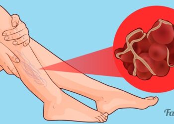 come-fluidificare-il-sangue-alimenti