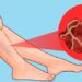 come-fluidificare-il-sangue-alimenti