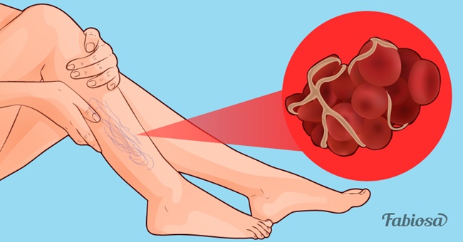 come-fluidificare-il-sangue-alimenti