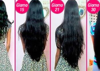 ricrescere-i-capelli