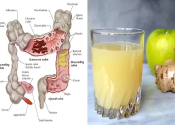 Il succo che svuota l’intestino da tossine