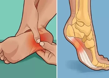 Ti fanno male i talloni al mattino o quando stai in piedi