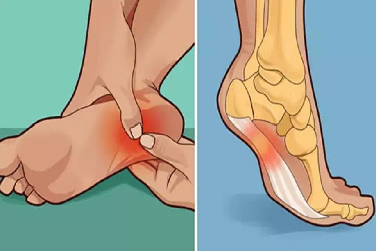 Ti fanno male i talloni al mattino o quando stai in piedi