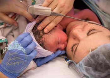Quattro giorni di travaglio e poi il neonato viene alla luce con le braccia aperte