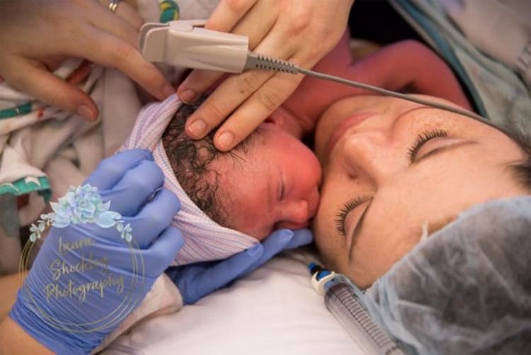 Quattro giorni di travaglio e poi il neonato viene alla luce con le braccia aperte