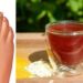 8 Rimedi naturali ed efficaci per alleviare i sintomi della gotta