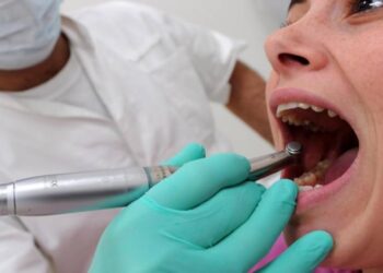 Le carie non sono ereditarie arriva la conferma scientifica