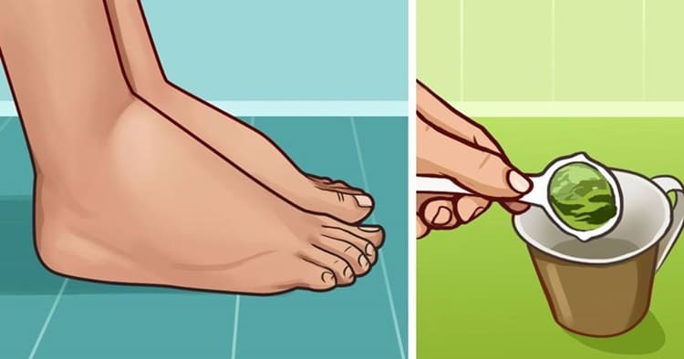 gambe-e-ritenzione-idrica