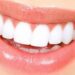 sbiancamento-denti-sostanze