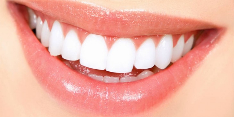 sbiancamento-denti-sostanze