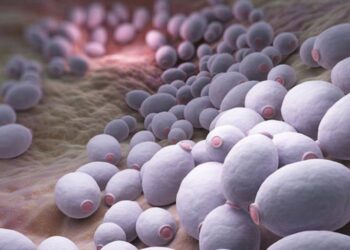 come-riconoscere-la-candida