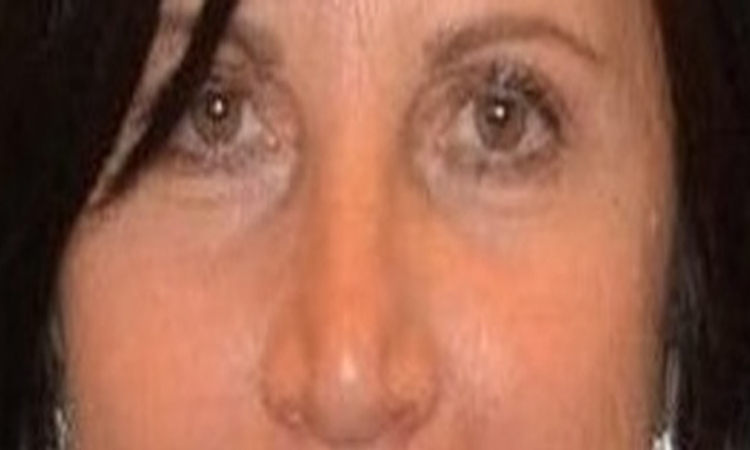 Silvana la mamma investita di ritorno dal cimitero per pregare suo figlio