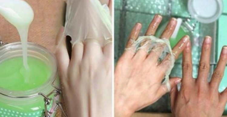 Miele yogurt e limone per le macchie della pelle: come schiarirle!