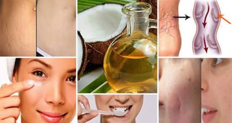 Olio esfoliante per curare l'herpes, l'acne, le smagliature e la dermatite