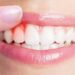 Collutorio fatto in casa per prendersi cura di denti e gengive!