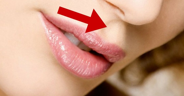 Arco di Cupido: cos'è il solco che si forma tra le labbra e il naso