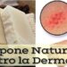 Sapone fatto in casa per la dermatite