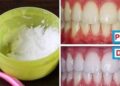Come sbiancare i denti