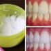 Come sbiancare i denti