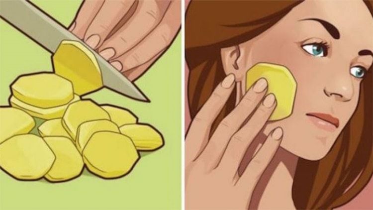 Pelle del viso perfetta: il rimedio a base di patate da seguire ogni sera