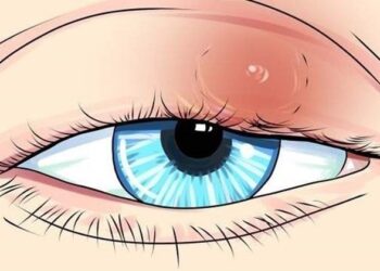 8 cose che gli occhi mostrano sulla nostra salute