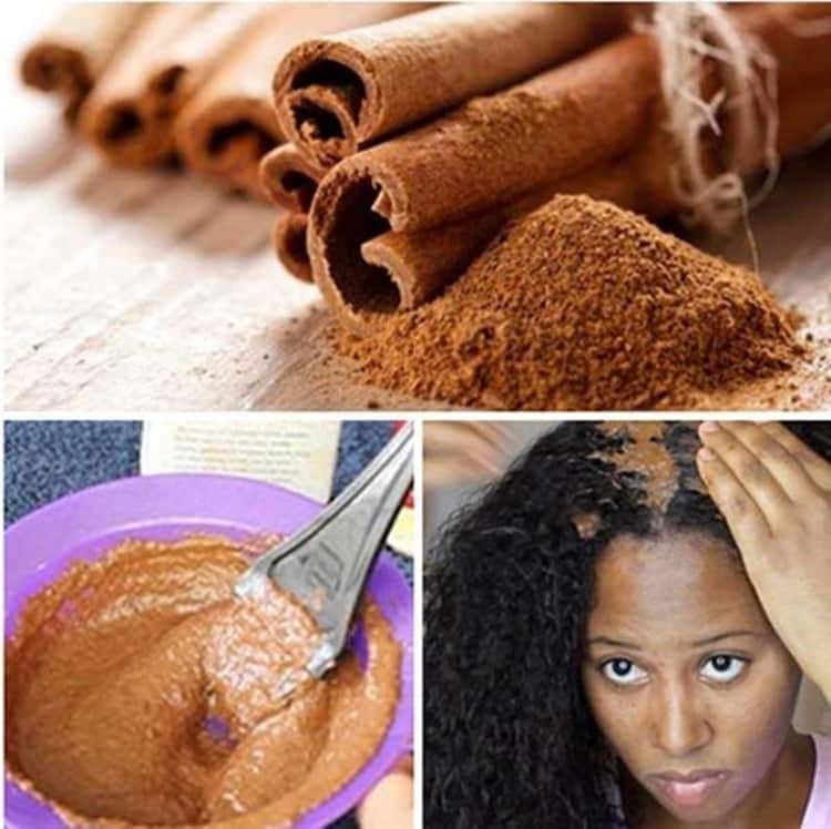 Fai ricrescere i capelli in soli 2 settimane con la cannella, scopri come