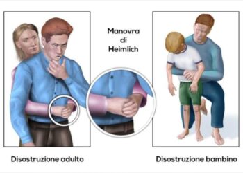 Manovra di Heimlich, la tecnica che salva la vita delle persone