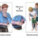 Manovra di Heimlich, la tecnica che salva la vita delle persone
