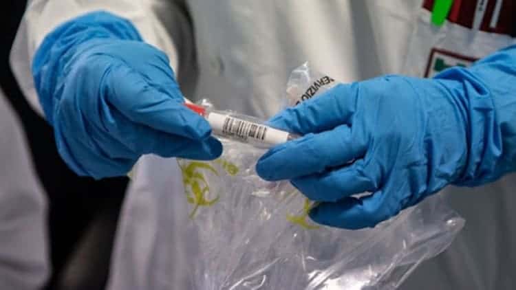 Inversione di tendenza, potrebbe essere la settimana cruciale contro il Coronavirus