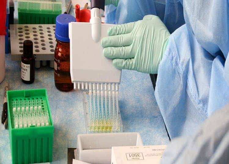 anticorpi-coronavirus-studio