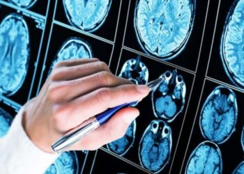 farmaco-contro-alzheimer