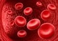 sintomi leucemia