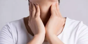 Tiroide di Hashimoto